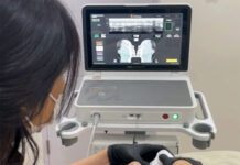 Ultherapy PRIME Resmi Hadir di Bandung, ADC Bawa Layanan Face Lift Tanpa Operasi